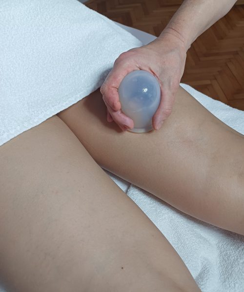 Anticelulitna masaža z ventuzami